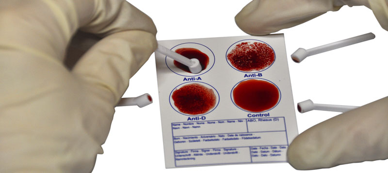 Резус фактор экспресс методом. Исследование группы крови. Анализ на определение группы крови. Резус-фактор крови. Исследование на резус фактор.